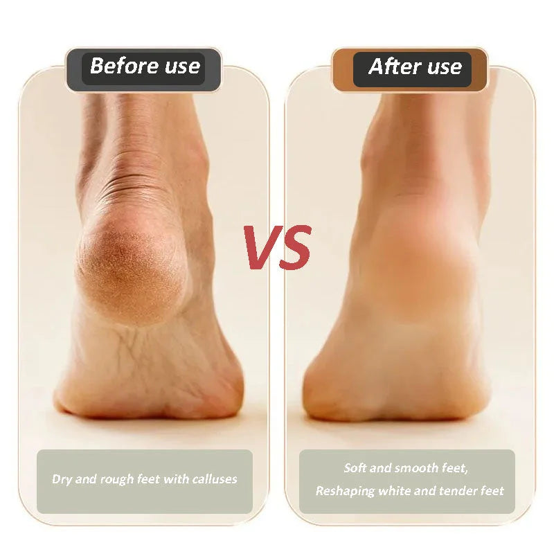 🔥HOT SALE💝New Digital Electric Foot Polisher【FREE SHIPPING】