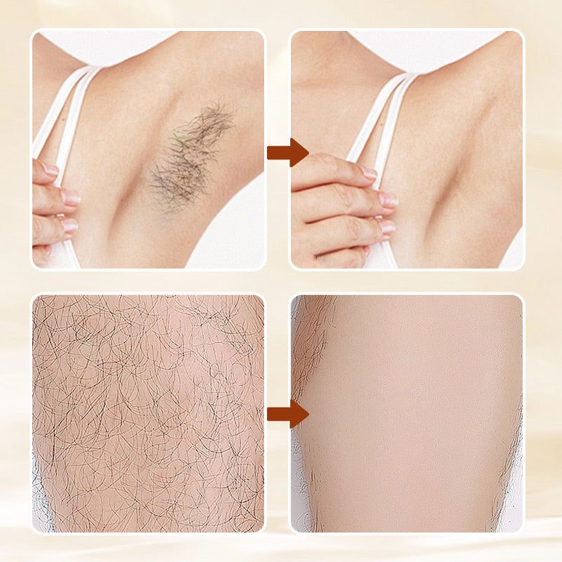 🧴40% OFF!🥰Versatile Aromatic Hair Removal Cream – Fast, Gentle & Fragrance-Infused for Silky Smooth Skin ✨