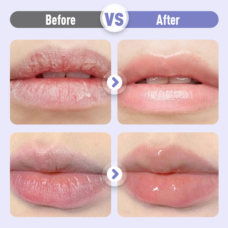 🔥BUY 1 GET 1 FREE🔥|Plumping & Anti-Wrinkle Hydrating Lip Serum💧💋